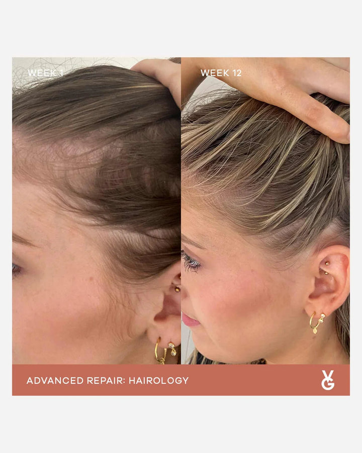 Hairology Capsules Anagain Hair Growth Supplement